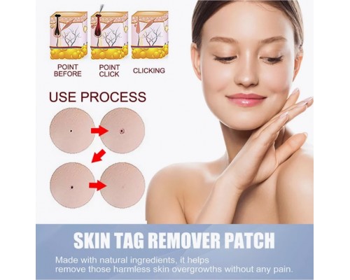 Гидроколлоидные патчи от прыщей Skin Tag оптом