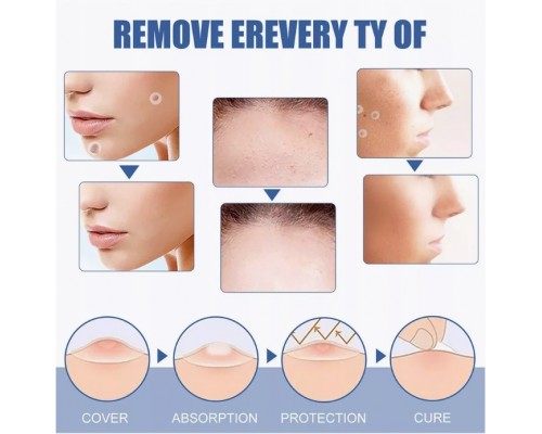 Гидроколлоидные патчи от прыщей Skin Tag оптом