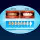 Система для отбеливания зубов 20 Minute Dental White оптом